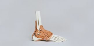 Fascite plantar: como prevenir e tratar a dor na planta do pé